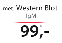 Western Blot IgM