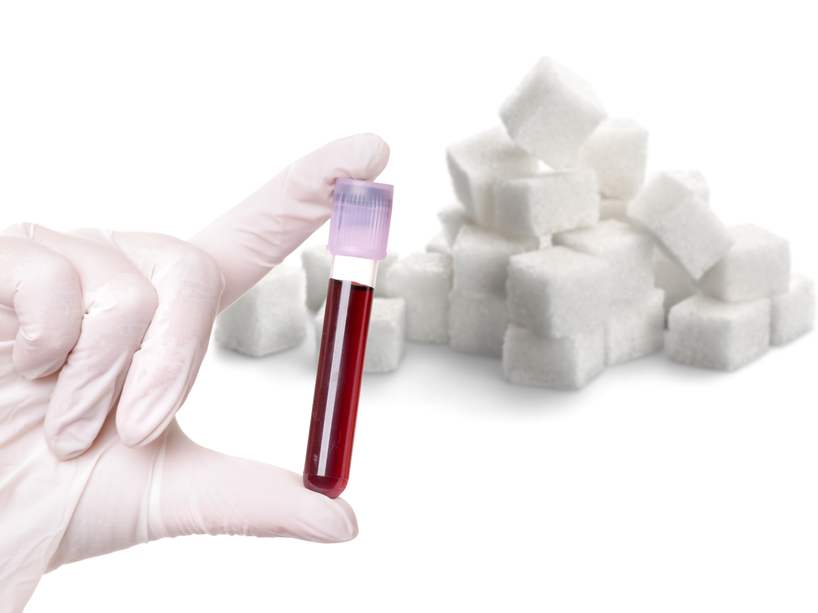 Krzywa cukrowa i krzywa insulinowa – 2 podstawowe badania w diagnostyce cukrzycy