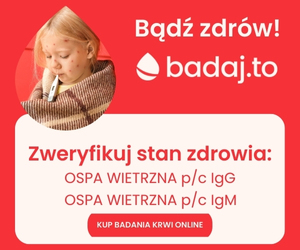 ospa wietrzna