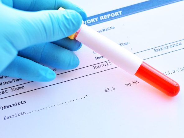 Badanie poziomu ferrytyny w diagnostyce gospodarki żelazem
