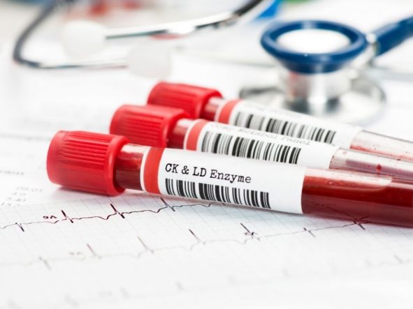 Co obejmują podstawowe badania krwi?