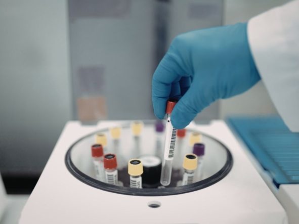 Jakie badania trzeba robić na czczo?