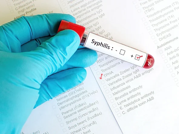 Kiła – niechciana pamiątka z wakacji