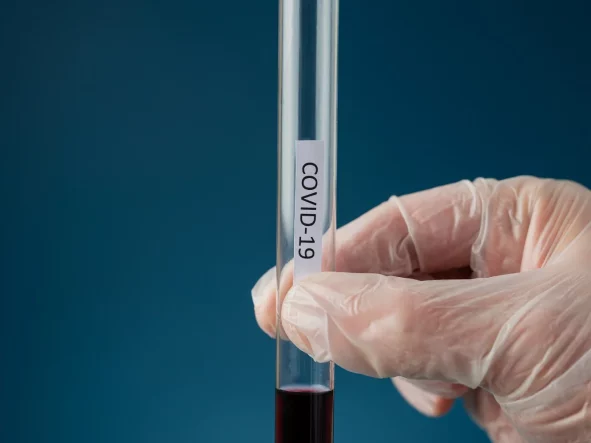 Koronawirus SARS-CoV-2 przeciwciała IgG ilościowo