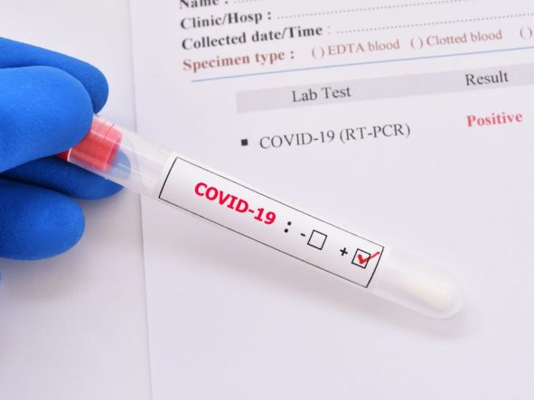Testy antygenowe SARS-CoV-2 w diagnostyce koronawirusa