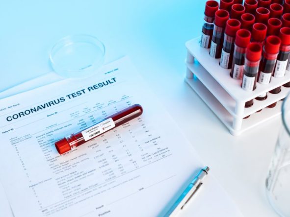 Testy na koronawirusa