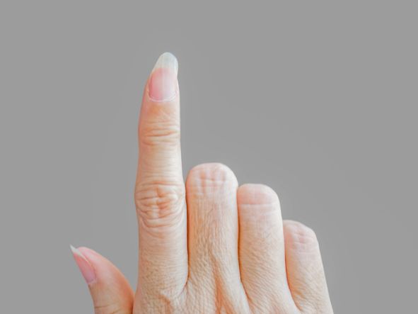 Kruche i łamliwe paznokcie – co zrobić?