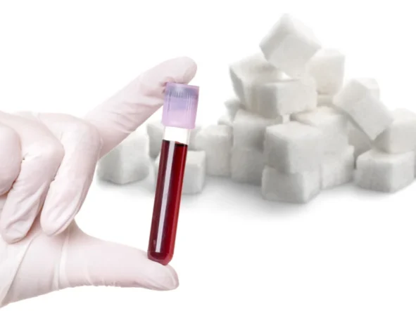 Krzywa cukrowa i krzywa insulinowa – 2 podstawowe badania w diagnostyce cukrzycy