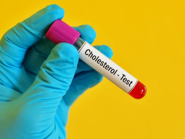 3 pytania o lipidogram