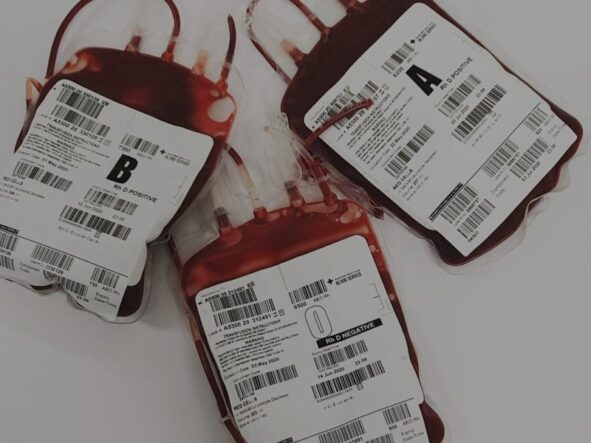 Jak sprawdzić grupę krwi? Wszystko o badaniu grupy krwi!