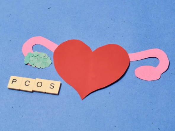 PCOS (zespół policystycznych jajników) – objawy, leczenie, diagnostyka