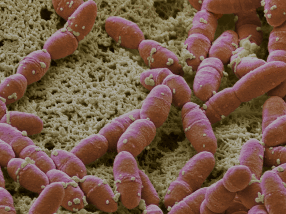 Szkarlatyna – objawy, leczenie i przyczyny
