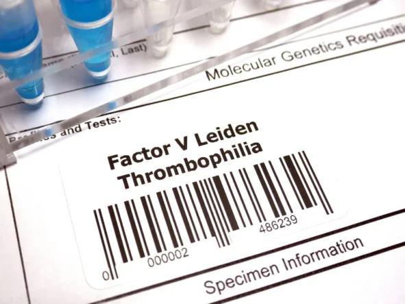 Tromboflia, czyli żylna choroba zakrzepowo-zatorowa (ŻChZZ)